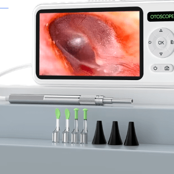 Ear digital Endoscope