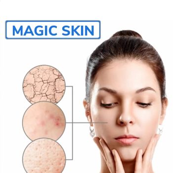 Glycolic Acid Peel results