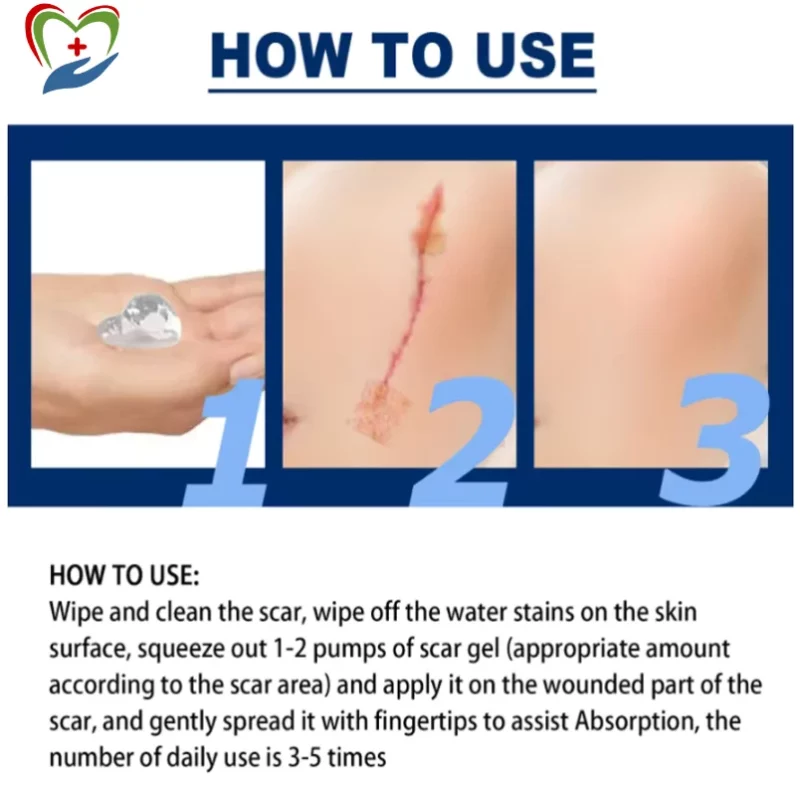 Scar Removal Gel Cream how to use