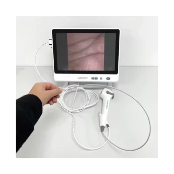 SY-P0029-3 Disposable Ureteroscope with Screen Monitor - Image 2