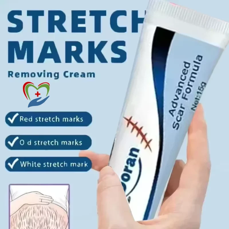 Stretch Mark Cream benefits