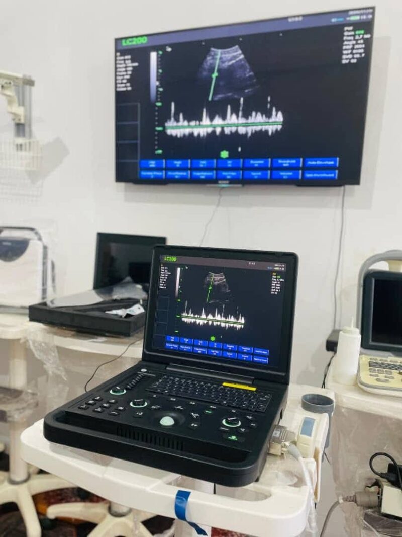 Portable Laptop Ultrasound