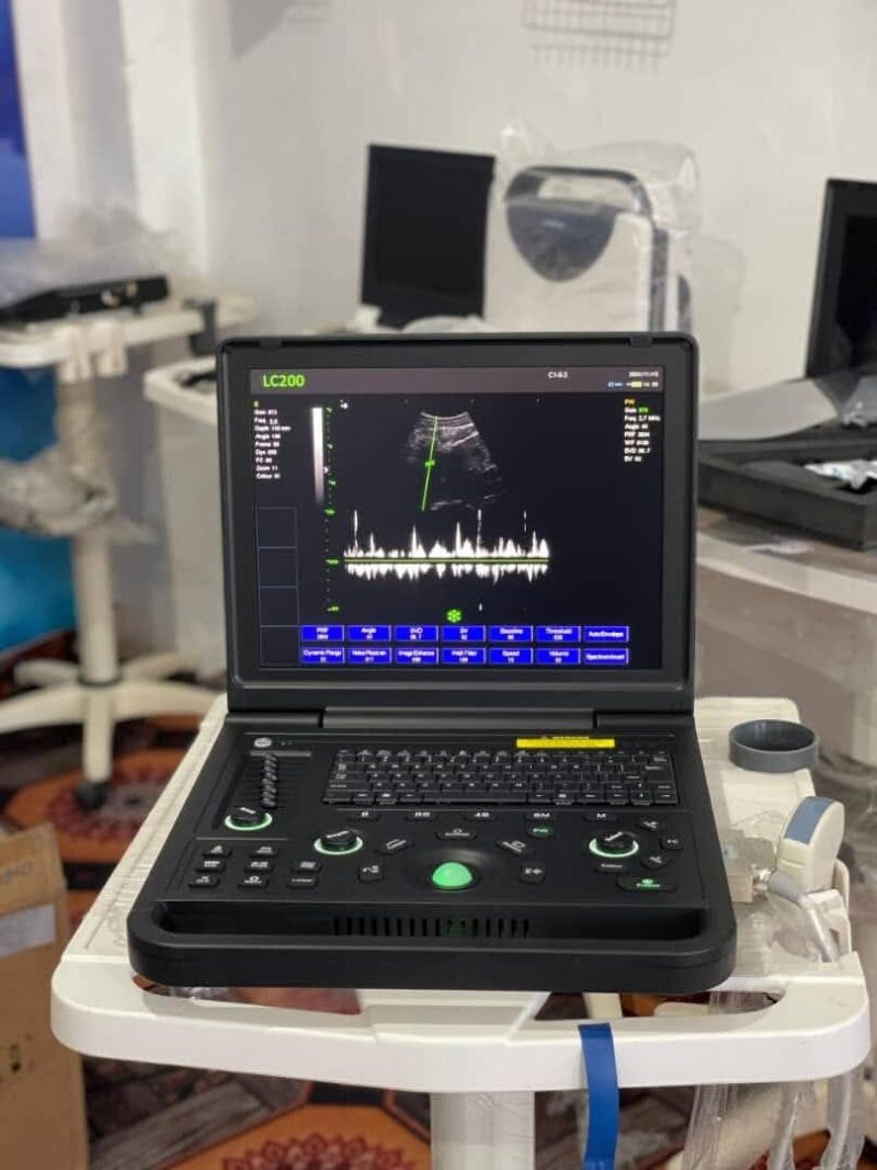 Portable Laptop Ultrasound