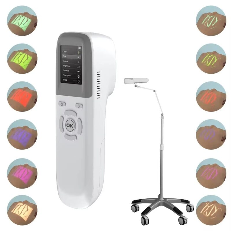 QV-600 Vein Finder Machine – Handheld Infrared Vein Light for Face & Hand | Aesthetic Clinic Use - Image 2