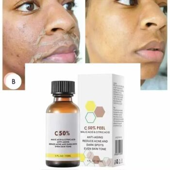 Peel Serum