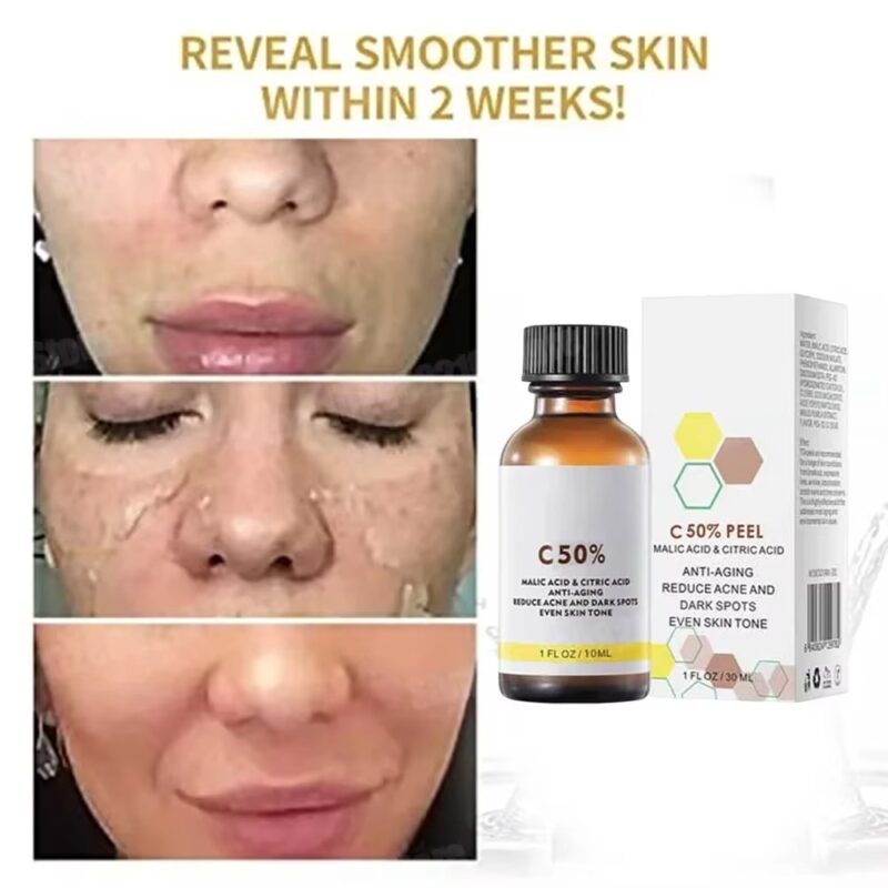 Salicylic Acid Facial Peel with Neutralizer – Deep Exfoliating Chemical Peel Serum for Clear, Refined Skin - Image 4
